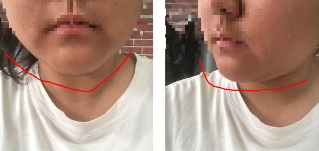 腾讯内容开放平台