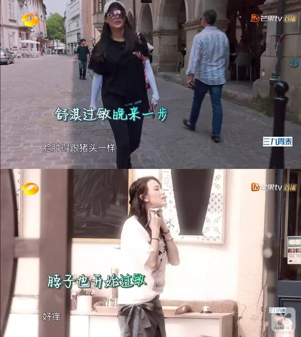 过敏体质快跟着舒淇学学抗敏急救术吧!