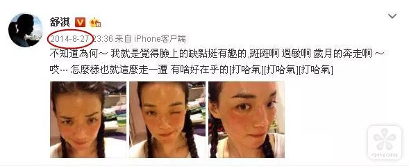 过敏体质快跟着舒淇学学抗敏急救术吧!