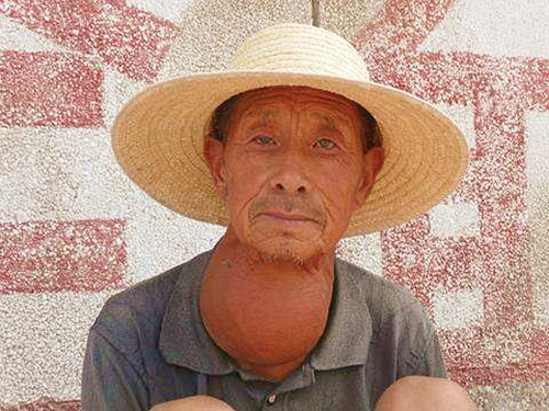 "大脖子病"甲状腺癌和盐有关系?日常中真的不能吃加碘的盐吗?