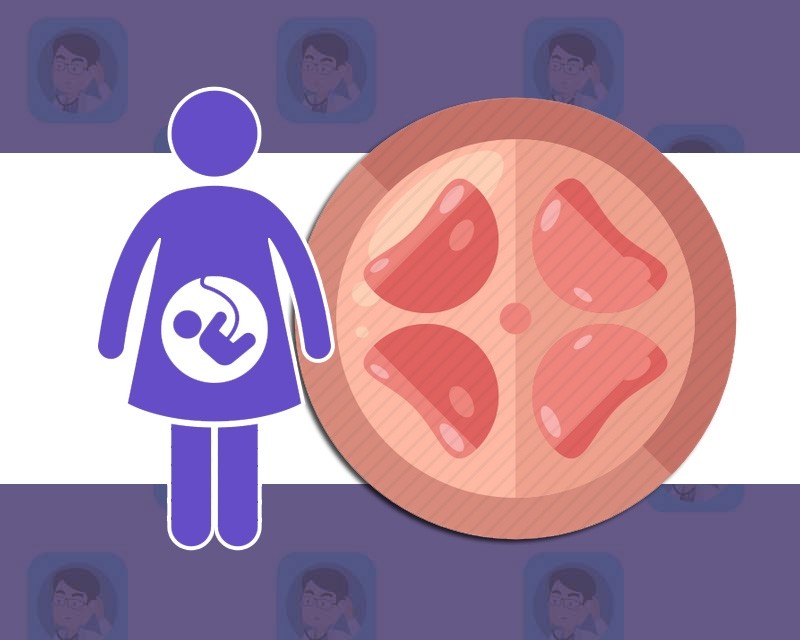 《如懿传》周迅矫正胎位却难产:胎位不正真得