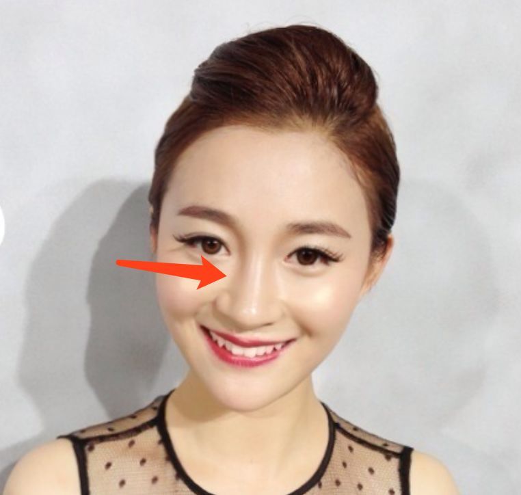 吴秀波疑似小三吐槽张芷溪是整容鸡,自己整了