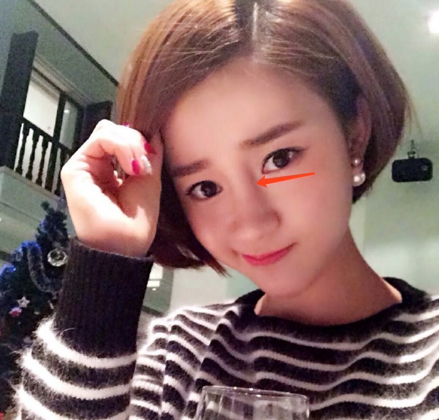 吴秀波疑似小三吐槽张芷溪是整容鸡,自己整了