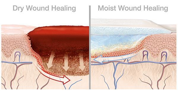 医美面膜就能任性敷?能加速伤口修复,但不是包