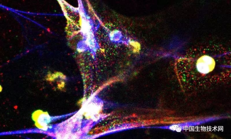 Science:是什么唤醒了休眠的癌细胞?