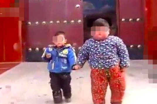 2岁孩子体重83斤,父母以为孩子有病,检查后奶