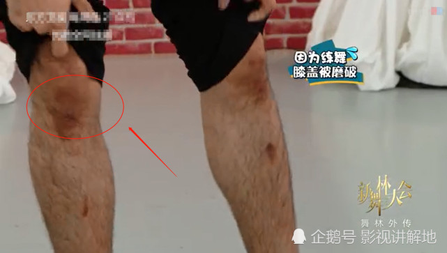 护膝里面藏有针,工作人员的态度引众怒!