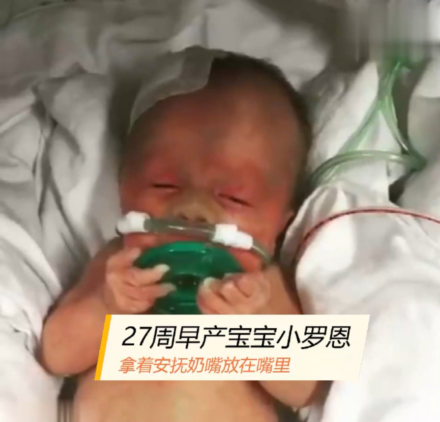 27周早产儿,出生才七周自己就会含着安抚奶嘴
