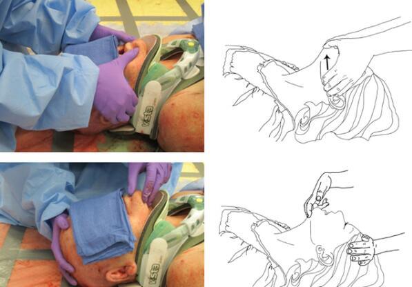 上为仰头抬颏法,下为托颌法