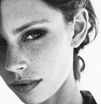 仅仅只需要一招,就可以和"麻子脸"说再见