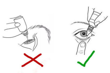 副作用|眼药水|结膜
