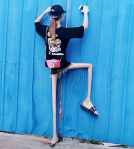 抖音惊现"筷子腿"!什么才是筷子?这腿是发育不全吗