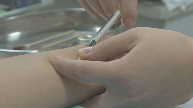 医生:一般的皮试的部位是在前臂掌侧的下端,因为这个地方的皮肤比较薄