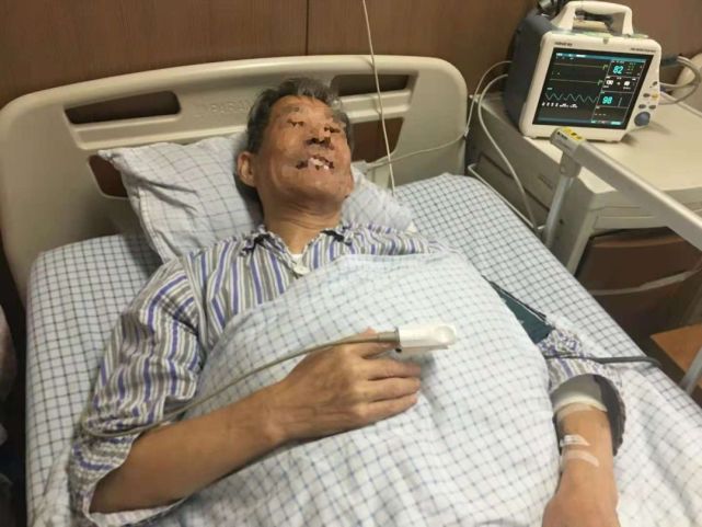 早年著名演员傅彪,虽历经二次肝移植,生命的休止符定格在了42岁;今年9