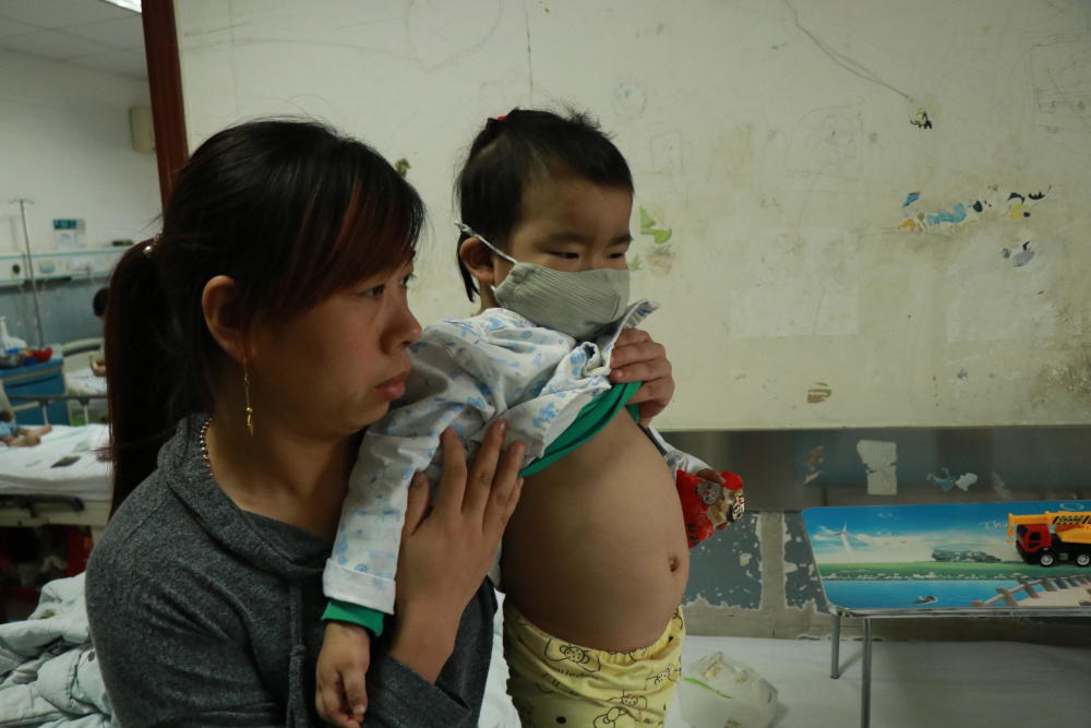 两岁娃发高烧辗转5家医院 化疗后络腮胡10厘米