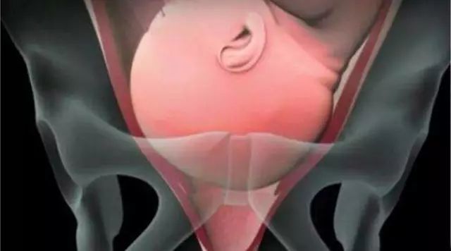 这些信号被称为"临产先兆"1信号1,入盆初产妇胎儿一般会在第36周入盆