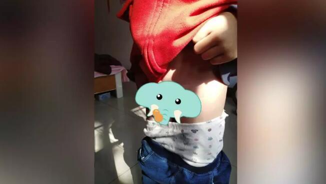 这到底是咋弄的,问了半天他说同学弄的,说我上厕所的时候尿尿同学拽的