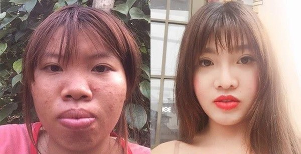 整容后的小凤近日,媒体报道,越南一名网红小凤,又