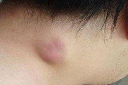 观察加留意,错当成感冒的5种疾病,危害比