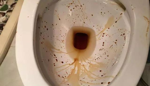 但是呢这个马桶用时间久了,不清洁就会变得非常的脏,上面这些黄渍尿渍