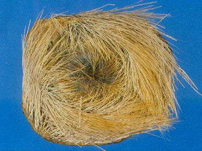 难道宫斗剧中的"滑胎药",真的那么神?看看医生怎么说