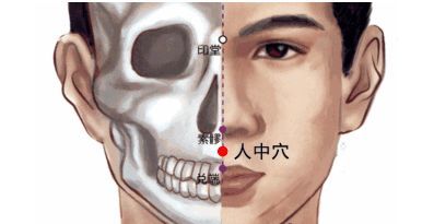 方法:用大拇指掐人中,反覆刺激到人醒為止.