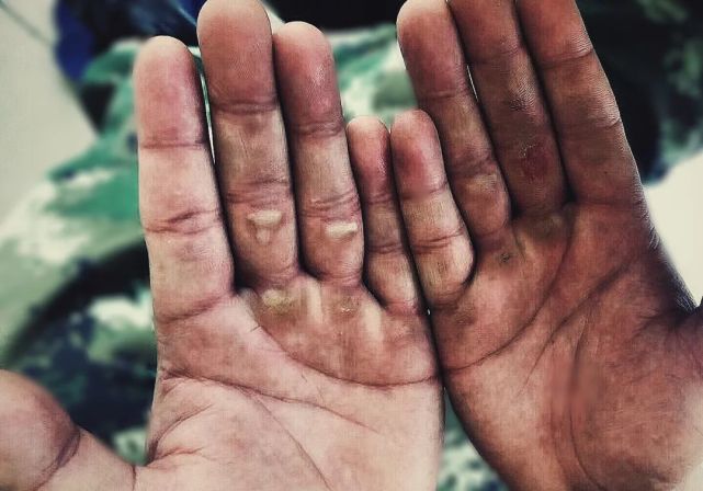 掌心老茧 定是时光的刻痕 关节粗大 像是结实的钩梯 厚实的力度 正