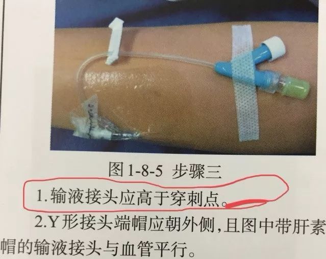 查看更多图片 >通常认为,外周静脉留置针需要u型固定,输液接头/肝素帽