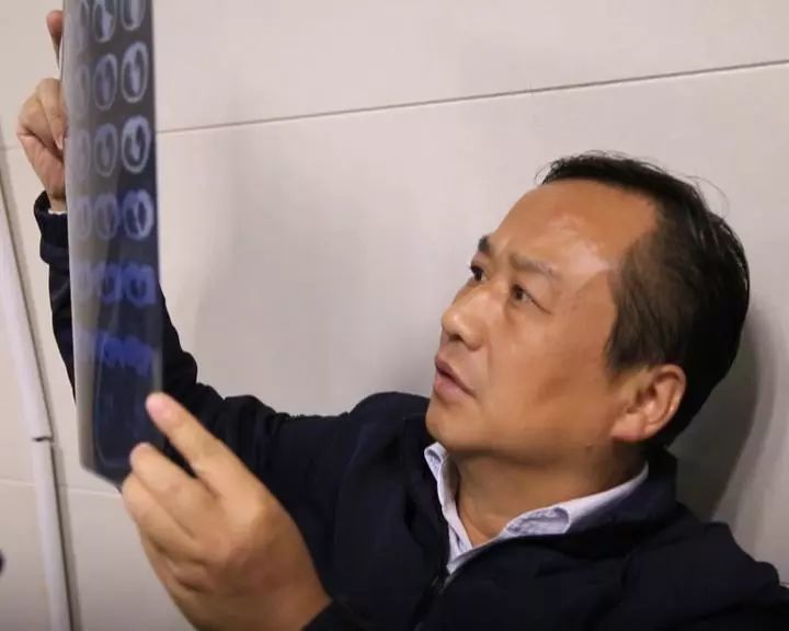 不仅如此,在吴院长在查看了林林肺部的ct照片后,确认林林的肺部也出现