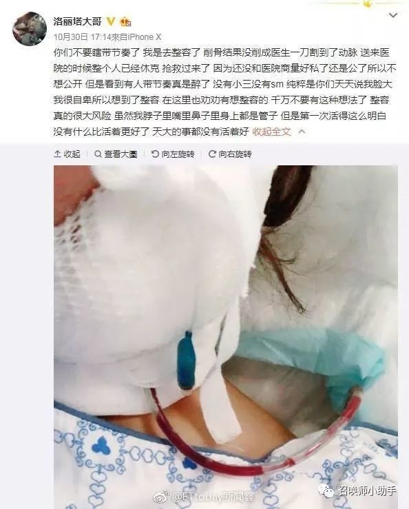 斗鱼洛丽塔整容失败,医生误割大动脉致休克进icu!