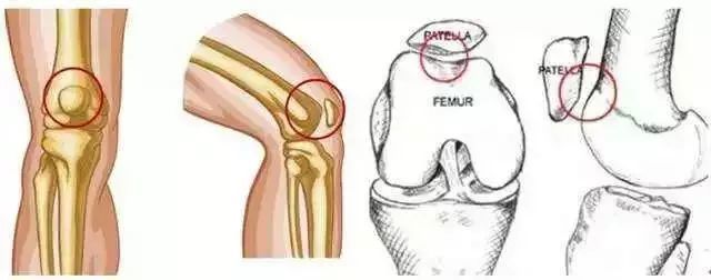 膝關節常見損傷特徵總結