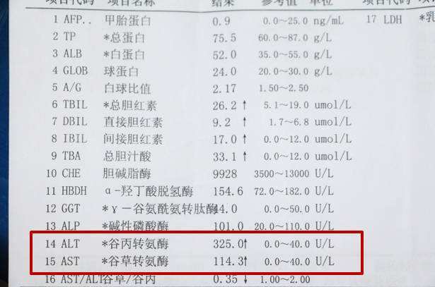 血液检查发现1数值异常 警惕肝病恶化 多吃二物 远离肝病 腾讯网
