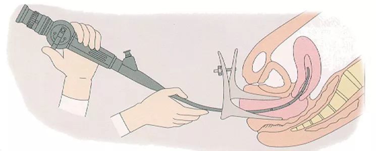 网站SEO诊断性刮宫 腾讯网