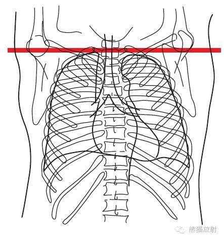 第一層:胸廓入口水平從胸廓入口至主肺動脈窗水平,從氣管隆突下至肝