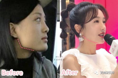 杨幂唐嫣瘦成皮包骨筷子腿,居然还有双下巴