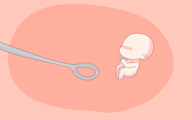 怀孕超过这个月不叫打胎,叫引产,胎儿会很痛,请