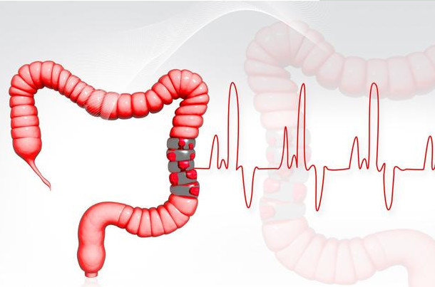 做完肠镜检查后,肚子会痛几天?超过这个时间就