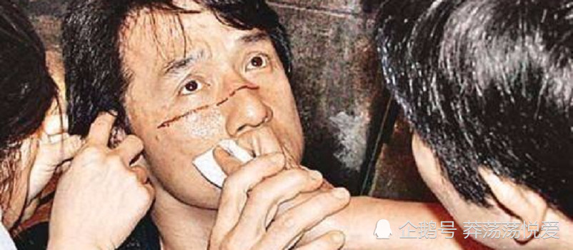 与死神擦肩而过的明星,第位遭遇