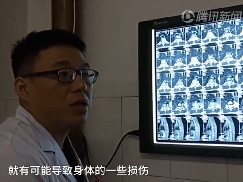 8岁女孩练舞蹈受重伤,医生建议:小孩学跳舞,应