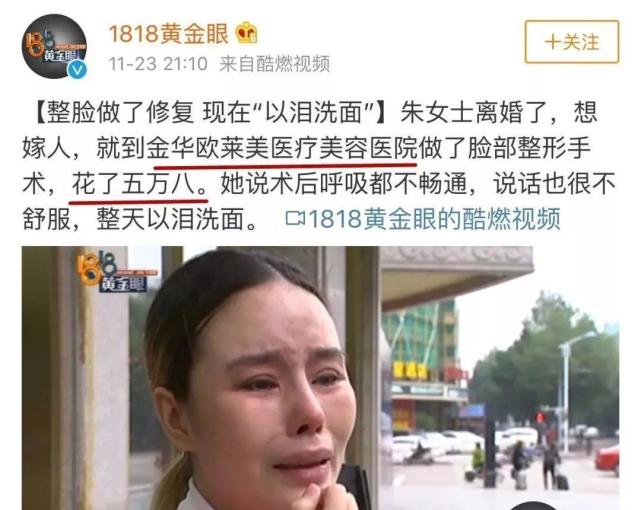 大型整容拔草节目1818黄金眼女子花了5万8把脸整成这样