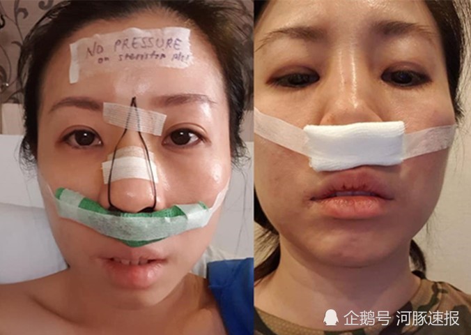 陈宝珊日常照片