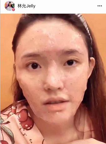 林允大小眼的严重程度已经升级成假眼了?