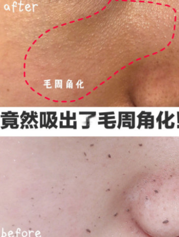 皮肤摸起来凹凸不平 这样做让你恢复光滑平整鸡蛋肌 拥有少女感