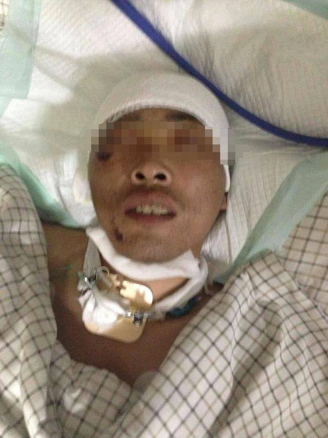 昌图县有多少人口_昌图一家5口遭遇车祸1死4伤夫妻二人至今未脱离生命危险
