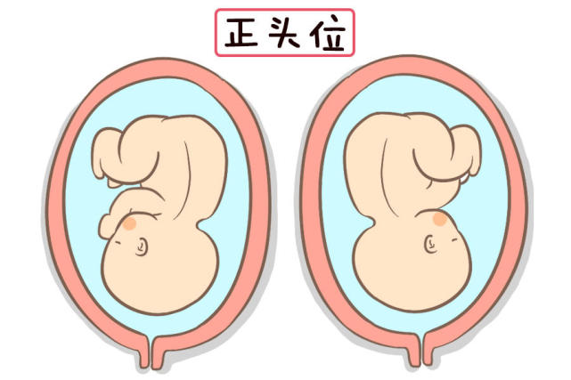 孕妈知道胎儿的头和脚在哪个位置吗 没准和你想的判断方法不一样 孕妈 胎儿 孕晚期 产检 胎动