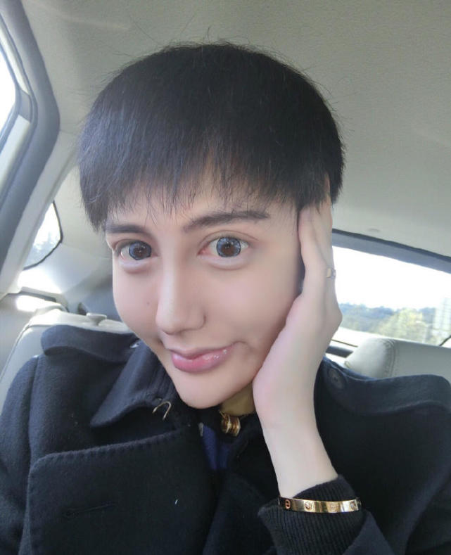 "蛇精男"找医生鉴定 坚称脸为纯天然