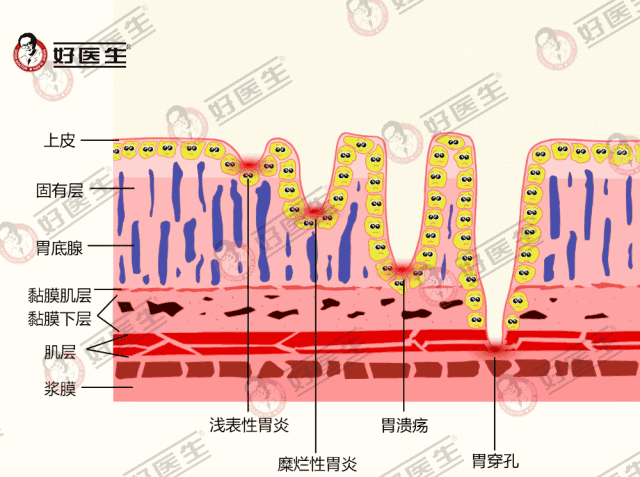 反酸胃灼烧人群注意了这种食物可以缓解此类症状