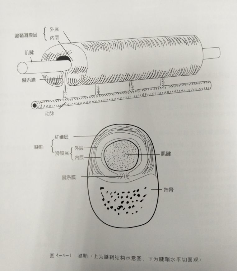 针刺治疗腱鞘囊肿