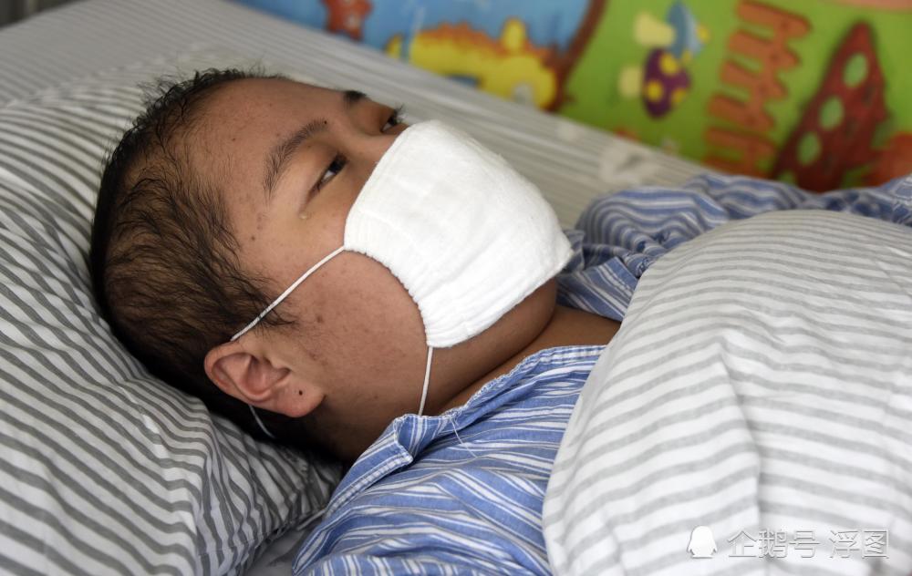 妙龄女孩吃激素药变男人 身上腿上长汗毛与以