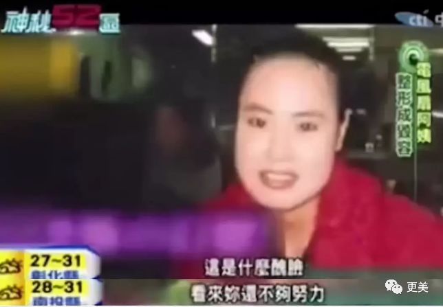 美到撞脸王祖贤却整形上瘾 自己往脸上注射机油后 毁容去世了